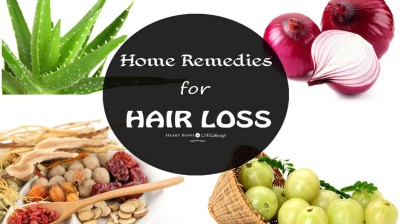 WHAT TO DO IF YOU ARE GOING BALD AS A WOMAN.